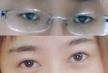 實地探訪暑期整容熱潮，為什么母親要求我整容？
