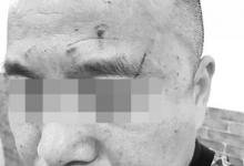 女醫(yī)生稱因不會宰病人被領導打 院長：她先動手