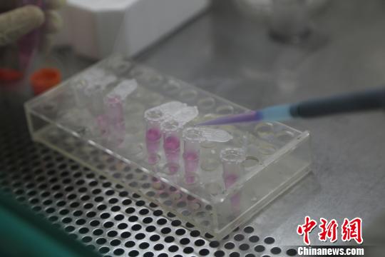 中國科學家首創I型糖尿病全新治療性DNA疫苗 中國科學家首創I型糖尿病全新治療性DNA疫苗