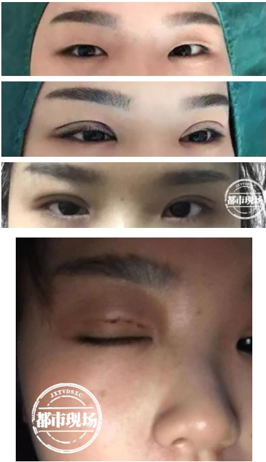 南昌愛玩美皮膚身材管理中心涉嫌無證行醫 女子花5800元整形失敗-易網健康<a href=http://www.fnaogov.cn/jkys/ target=_blank class=infotextkey>養生</a>網 南昌愛玩美皮膚身材管理中心涉嫌無證行醫 女子花5800元整形失敗