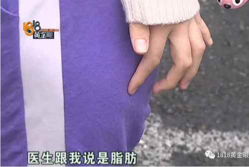 杭州麗星醫療美容醫院好不好？頻遭投訴效果差