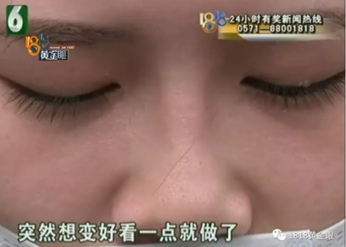 杭州世彩整形又遭消費者投訴 采訪時院方代表有些激動