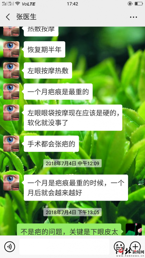 河北一女子在石家莊萬瑞醫療整形后眼睛閉不緊 醫院：不滿意可二次修復