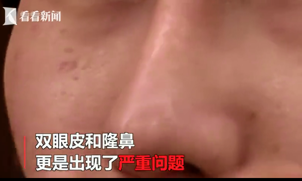 貴陽聚星妍美整形醫院怎么樣？女子做4項整形都失敗 還遭言語羞辱