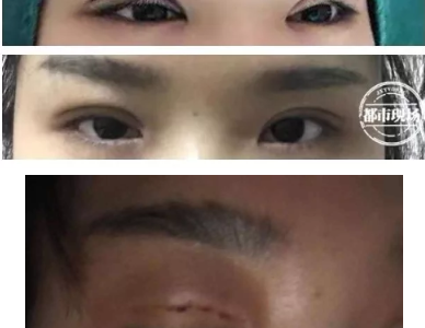 南昌愛(ài)玩美皮膚身材管理中心涉嫌無(wú)證行醫(yī) 女子花5800元整形失敗
