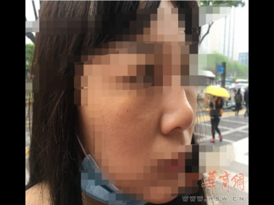 西安藝星美容整形醫(yī)院：醫(yī)美沒有統(tǒng)一標準 鼻子凹凸不平屬于正常