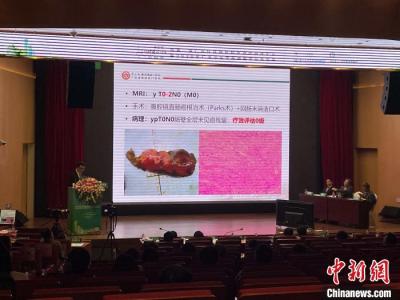 中國(guó)結(jié)直腸癌高發(fā) 專家指出不能忽略指檢