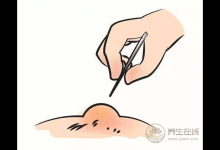 燙傷了怎么辦？6個處理誤區，還有很多人用