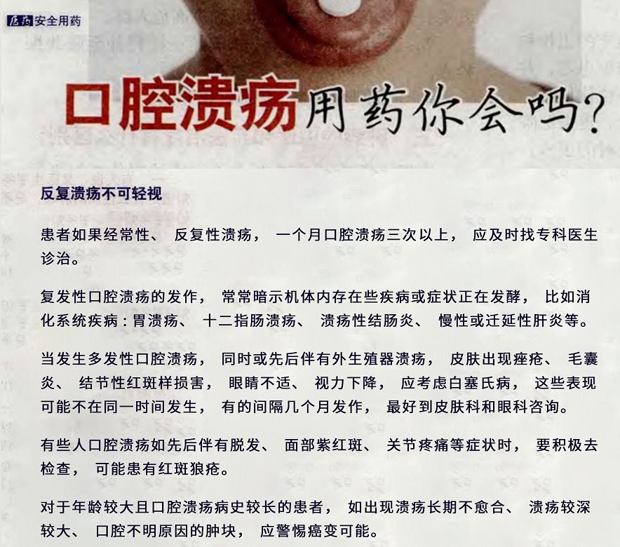 口腔潰瘍疼到崩潰?用它10秒止痛，2天就好，太神奇了！