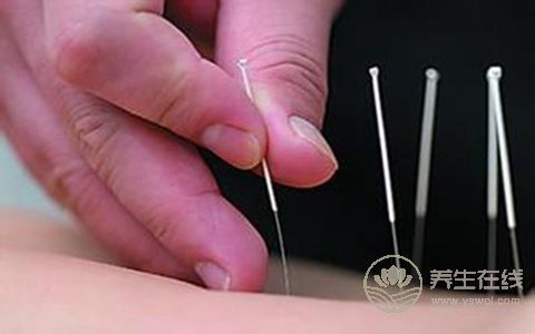 找準針灸減肥五大穴位 塑造纖細身姿
