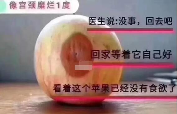 宮頸糜爛一二三度圖片，真實(shí)對比照片(小心是宮頸癌前兆)