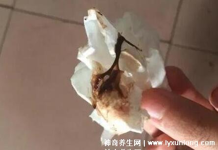 宮頸糜爛一二三度圖片，真實(shí)對比照片(小心是宮頸癌前兆)