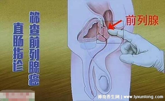 30秒自測前列腺炎，是否出現(xiàn)尿痛/尿頻/尿急(附自測方式)