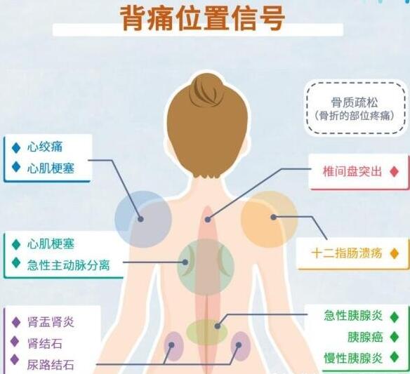 女性后背疼警惕四種病，腰部周圍痛小心婦科病(疼痛位置圖解)