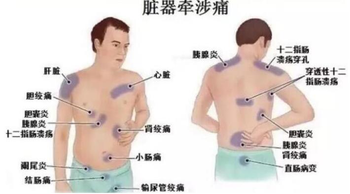 女性后背疼警惕四種病，腰部周圍痛小心婦科病(疼痛位置圖解)