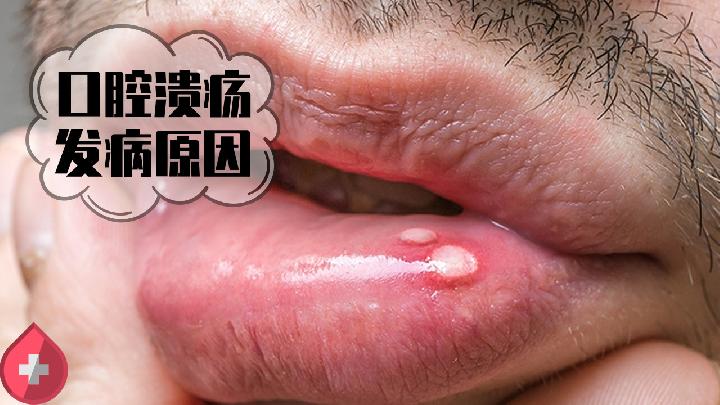 飲食提醒 餐桌上常做這5件事，便可輕松消除脂肪