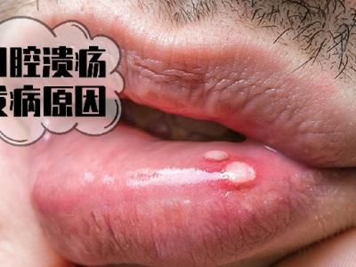 飲食減肥 如何合理的進行節(jié)食？