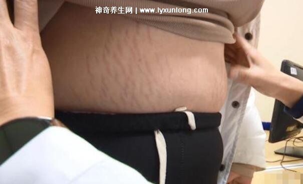 司美格魯肽注射減肥有副作用嗎多少錢，550元正常人打很危險