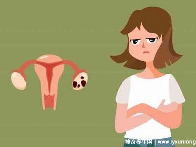 子宮肌瘤最怕三個運動，激烈的運動和夫妻生活導致肌瘤增大
