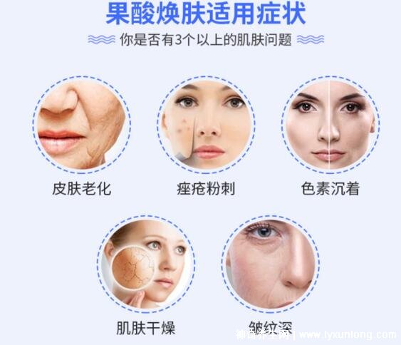 果酸換膚多少錢一次，1000-3000元不等(細致毛孔/淡化痘印)