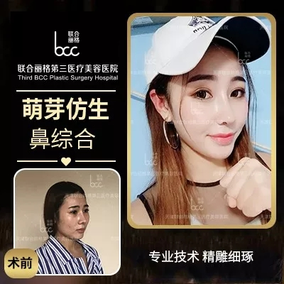 【隆鼻的“潛規(guī)則”】醫(yī)生是“看人收費(fèi)的”？