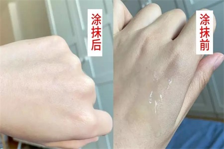 敏感肌膚用什么護(hù)膚品？推薦這款護(hù)膚禮盒清爽過夏天
