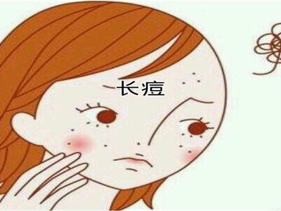 青春期女性長痘必非小事？可能要面臨的問題以及建議性護膚法