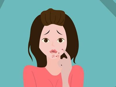 女性下巴長痘，原來是身體這里出問題，教你五招去除痘痘