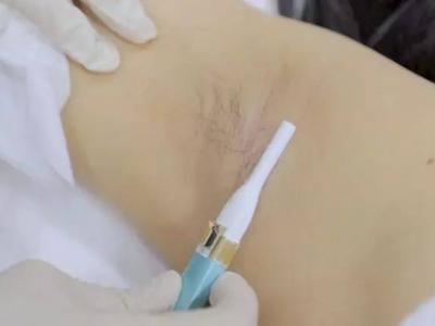 腋下脫毛后出汗多有異味怎么回事?腋下脫毛護(hù)理方法分享