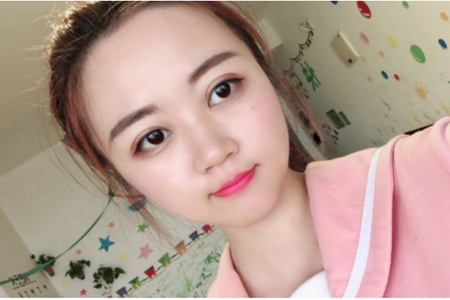 雙眼皮手術全切和埋線的差別，雙眼皮術后七個注意事項