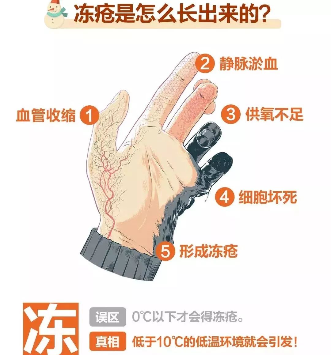 冬天天氣冷長凍瘡怎么辦?6個小妙招教給你-易網健康<a href=http://www.fnaogov.cn/jkys/ target=_blank class=infotextkey>養生</a>網 冬天天氣冷長凍瘡怎么辦?6個小妙招教給你