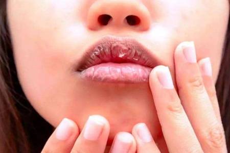 嘴唇干裂脫皮怎么辦，六個(gè)潤(rùn)唇方法養(yǎng)護(hù)嬌嫩嘴唇