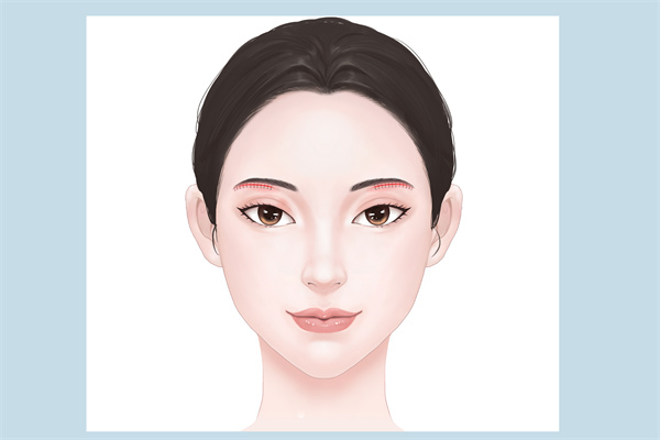 毛孔粗大如何治療?