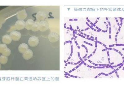 警惕炭疽，和新冠同一等級傳染病！