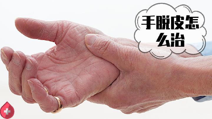 冬天手上皮膚發黑?5種原因要了解-易網健康<a href=http://www.fnaogov.cn/jkys/ target=_blank class=infotextkey>養生</a>網 冬天手上皮膚發黑?5種原因要了解