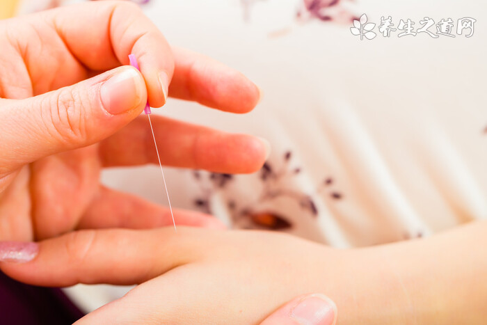 針灸的4種不良反應