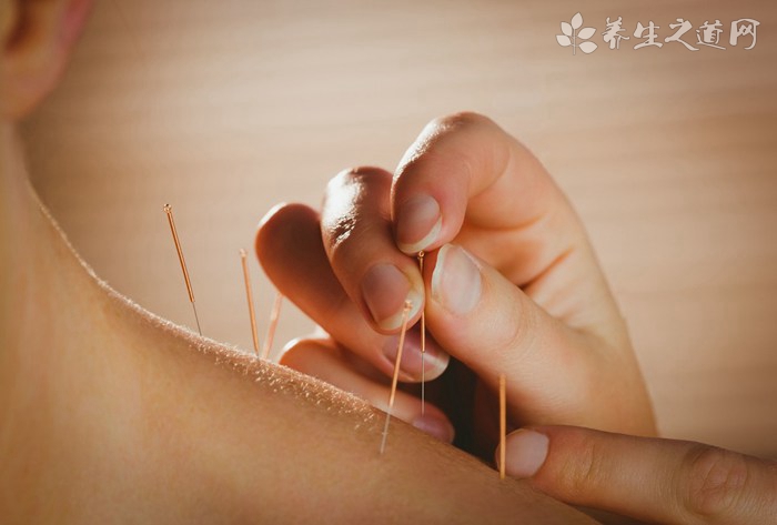 針灸后身體會虛嗎