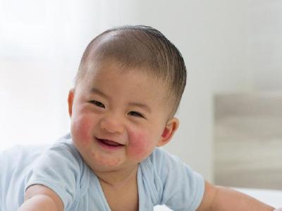 當孩子咳嗽時父母應(yīng)該怎么做？孩子咳嗽可以試試小兒推拿