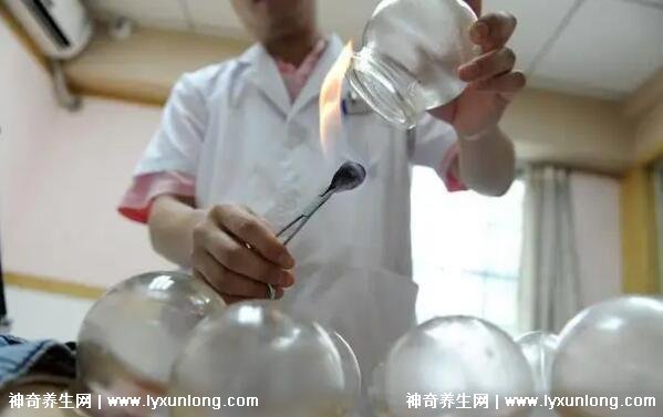 拔罐顏色癥狀對照表圖解，深淺代表不同病癥(越淺越好)
