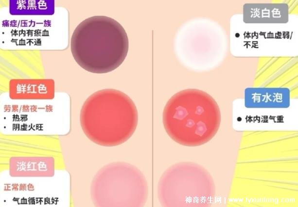 拔罐顏色癥狀對照表，紅色/黃色/藍色代表各不同(顏色深淺圖解)